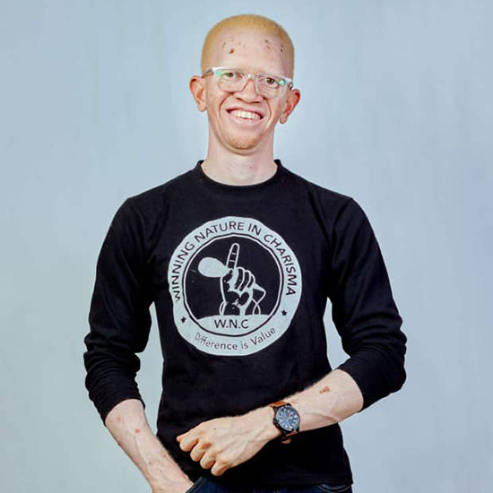 A light-skinned African man with red hair, wearing glasses and a black shirt that reads 'WINNING NATURE IN CHARISMA, Difference is Value' smiles at the camera.